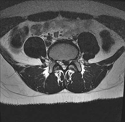 General Orthopedics 2026 Practice Questions: Set 7 (Solved) - Figure 100