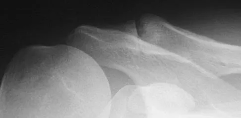 General Orthopedics 2026 Practice Questions: Set 7 (Solved) - Figure 104