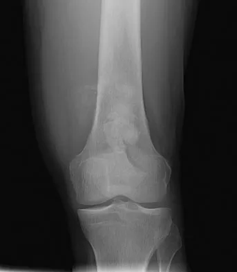 General Orthopedics 2026 Practice Questions: Set 7 (Solved) - Figure 11