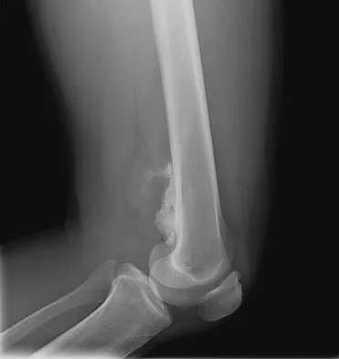 General Orthopedics 2026 Practice Questions: Set 7 (Solved) - Figure 12