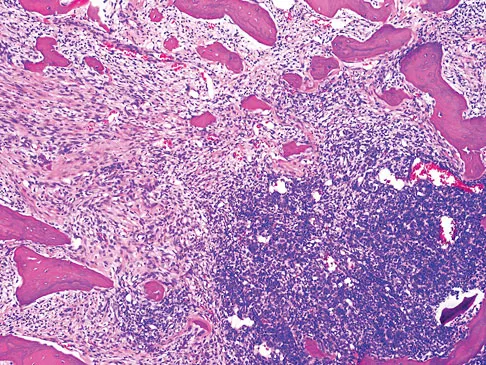 General Orthopedics 2026 Practice Questions: Set 7 (Solved) - Figure 16