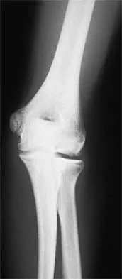 General Orthopedics 2026 Practice Questions: Set 7 (Solved) - Figure 17