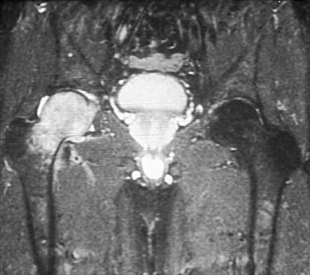 General Orthopedics 2026 Practice Questions: Set 7 (Solved) - Figure 18