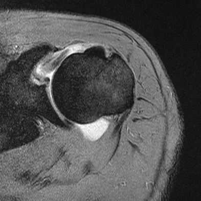 General Orthopedics 2026 Practice Questions: Set 7 (Solved) - Figure 2
