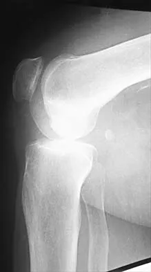 General Orthopedics 2026 Practice Questions: Set 7 (Solved) - Figure 21