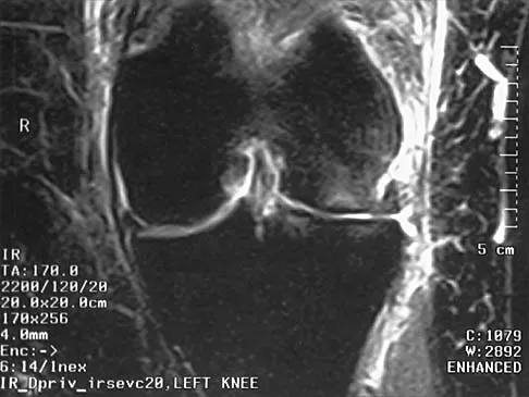 General Orthopedics 2026 Practice Questions: Set 7 (Solved) - Figure 22