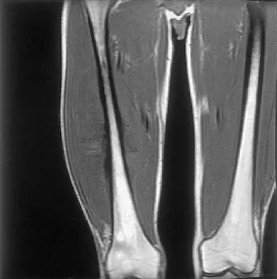 General Orthopedics 2026 Practice Questions: Set 7 (Solved) - Figure 24