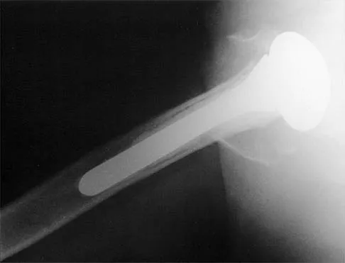 General Orthopedics 2026 Practice Questions: Set 7 (Solved) - Figure 27
