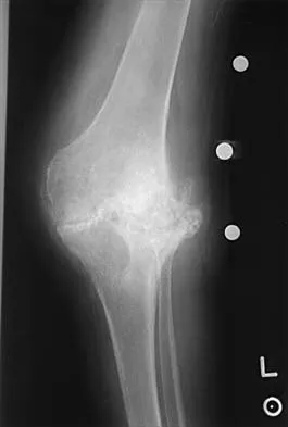 General Orthopedics 2026 Practice Questions: Set 7 (Solved) - Figure 3