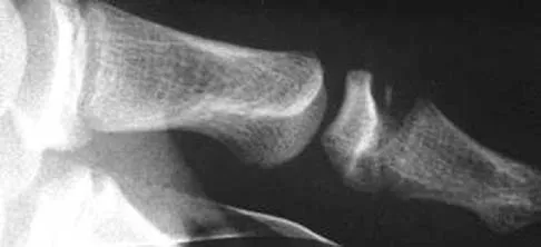 General Orthopedics 2026 Practice Questions: Set 7 (Solved) - Figure 32