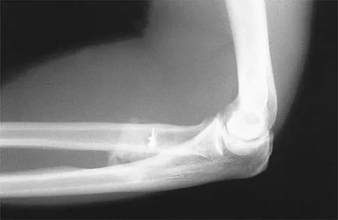 General Orthopedics 2026 Practice Questions: Set 7 (Solved) - Figure 34