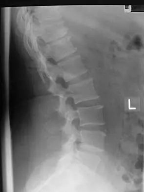 General Orthopedics 2026 Practice Questions: Set 7 (Solved) - Figure 36