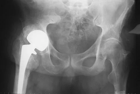General Orthopedics 2026 Practice Questions: Set 7 (Solved) - Figure 39