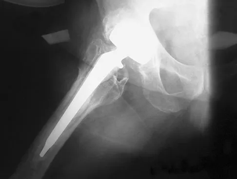 General Orthopedics 2026 Practice Questions: Set 7 (Solved) - Figure 40