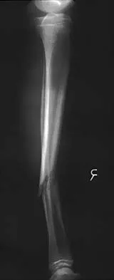 General Orthopedics 2026 Practice Questions: Set 7 (Solved) - Figure 44