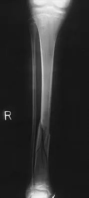 General Orthopedics 2026 Practice Questions: Set 7 (Solved) - Figure 45