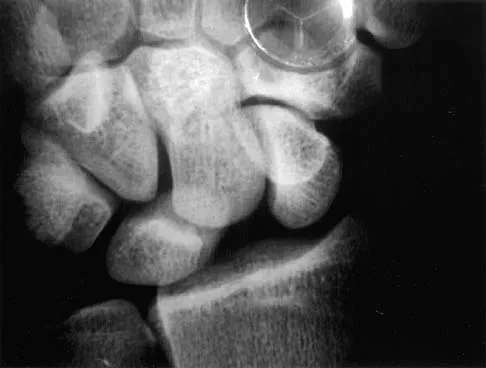 General Orthopedics 2026 Practice Questions: Set 7 (Solved) - Figure 46