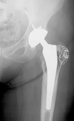 General Orthopedics 2026 Practice Questions: Set 7 (Solved) - Figure 49