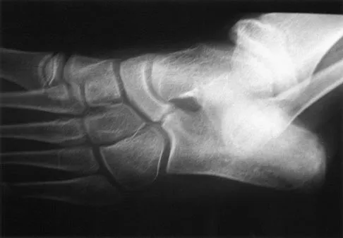 General Orthopedics 2026 Practice Questions: Set 7 (Solved) - Figure 5