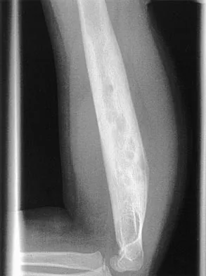 General Orthopedics 2026 Practice Questions: Set 7 (Solved) - Figure 51
