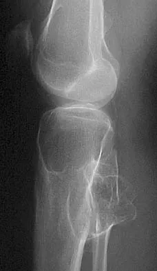 General Orthopedics 2026 Practice Questions: Set 7 (Solved) - Figure 53