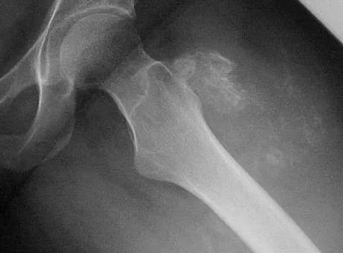 General Orthopedics 2026 Practice Questions: Set 7 (Solved) - Figure 54
