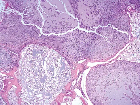 General Orthopedics 2026 Practice Questions: Set 7 (Solved) - Figure 6
