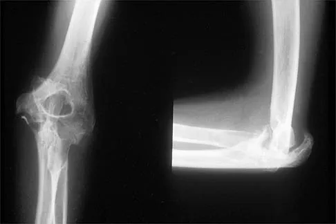 Click to enlarge General Orthopedics 2026 Practice Questions: Set 7 (Solved) - Figure 60