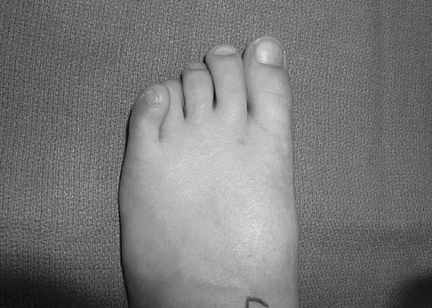 General Orthopedics 2026 Practice Questions: Set 7 (Solved) - Figure 61