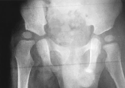 General Orthopedics 2026 Practice Questions: Set 7 (Solved) - Figure 64