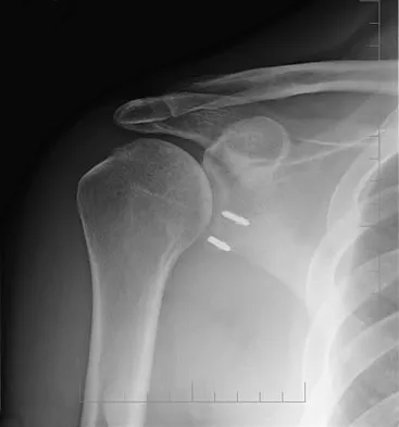 General Orthopedics 2026 Practice Questions: Set 7 (Solved) - Figure 65
