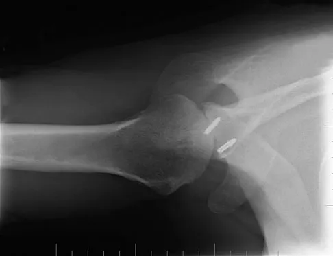 General Orthopedics 2026 Practice Questions: Set 7 (Solved) - Figure 66