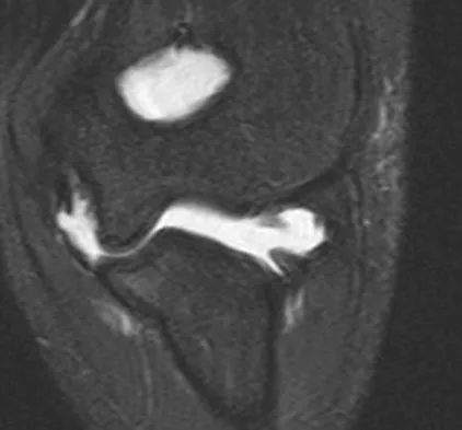 General Orthopedics 2026 Practice Questions: Set 7 (Solved) - Figure 68