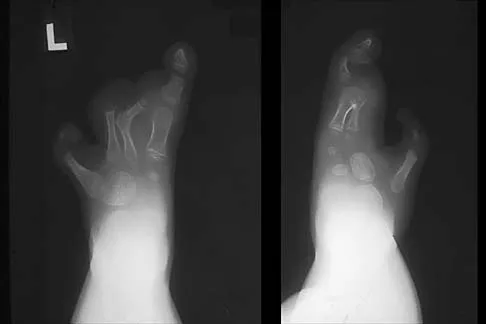 General Orthopedics 2026 Practice Questions: Set 7 (Solved) - Figure 69