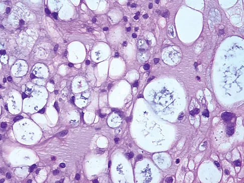 General Orthopedics 2026 Practice Questions: Set 7 (Solved) - Figure 7