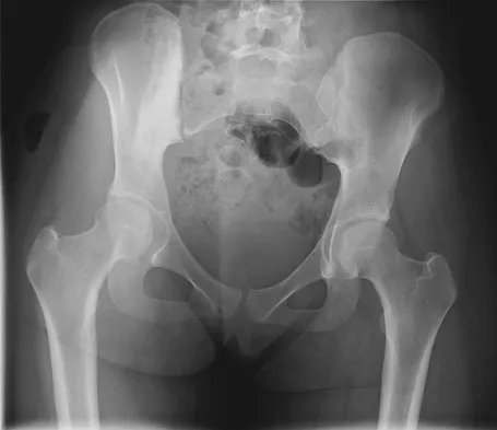 General Orthopedics 2026 Practice Questions: Set 7 (Solved) - Figure 70