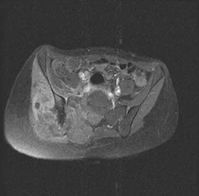 General Orthopedics 2026 Practice Questions: Set 7 (Solved) - Figure 71