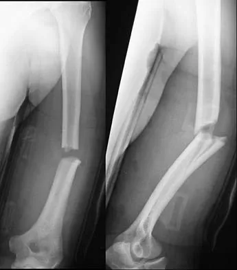 General Orthopedics 2026 Practice Questions: Set 7 (Solved) - Figure 73