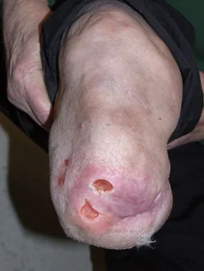 General Orthopedics 2026 Practice Questions: Set 7 (Solved) - Figure 82