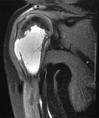 General Orthopedics 2026 Practice Questions: Set 7 (Solved) - Figure 87