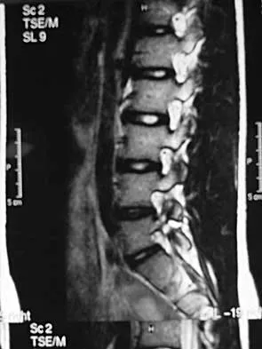 General Orthopedics 2026 Practice Questions: Set 7 (Solved) - Figure 93