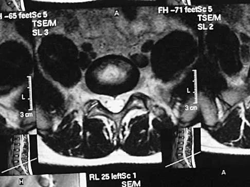 General Orthopedics 2026 Practice Questions: Set 7 (Solved) - Figure 95