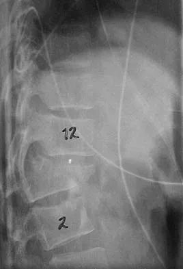 General Orthopedics 2026 Practice Questions: Set 7 (Solved) - Figure 96