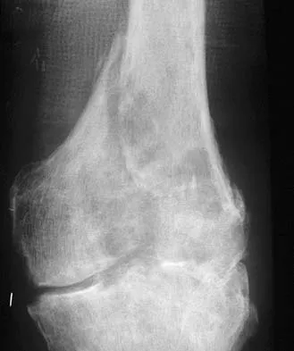 General Orthopedics Board Review 2026: High-Yield MCQs (Set 8) - Figure 1