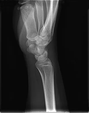 General Orthopedics Board Review 2026: High-Yield MCQs (Set 8) - Figure 13