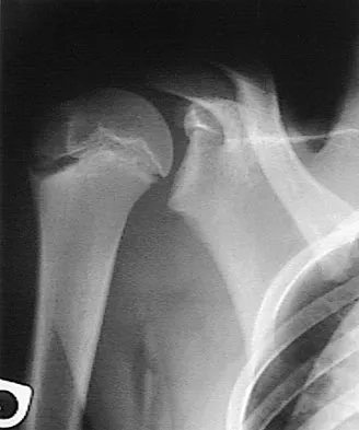 General Orthopedics Board Review 2026: High-Yield MCQs (Set 8) - Figure 14