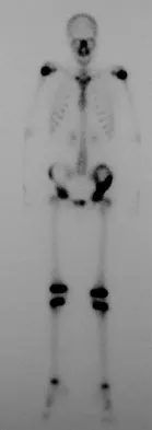 General Orthopedics Board Review 2026: High-Yield MCQs (Set 8) - Figure 16