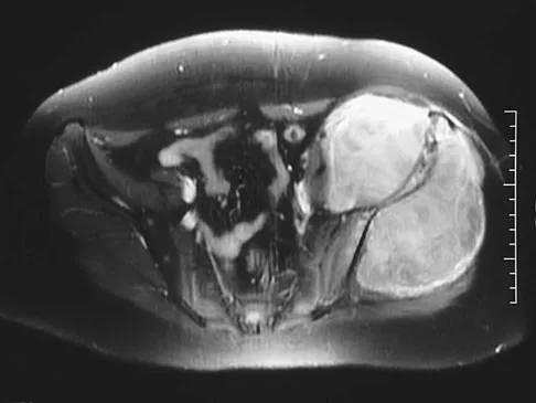 General Orthopedics Board Review 2026: High-Yield MCQs (Set 8) - Figure 17