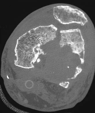 General Orthopedics Board Review 2026: High-Yield MCQs (Set 8) - Figure 2