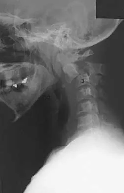 General Orthopedics Board Review 2026: High-Yield MCQs (Set 8) - Figure 22